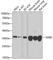 GNB2 Rabbit pAb