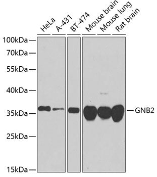 GNB2 Rabbit pAb