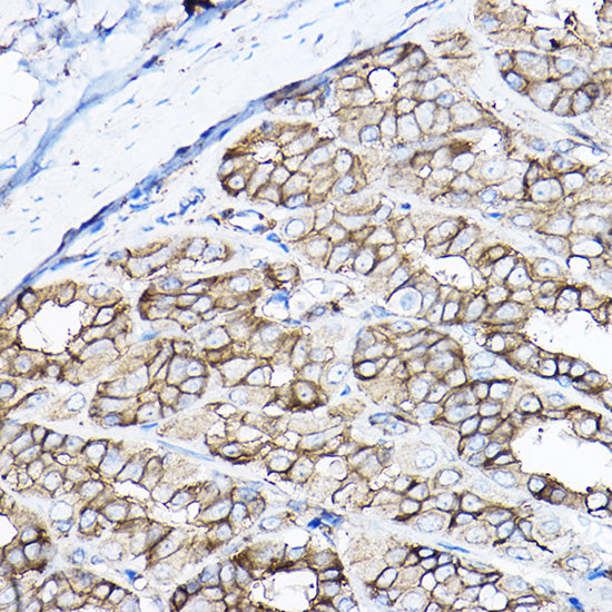 GNB2 Rabbit pAb