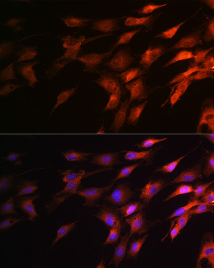 Neurofilament H Rabbit pAb