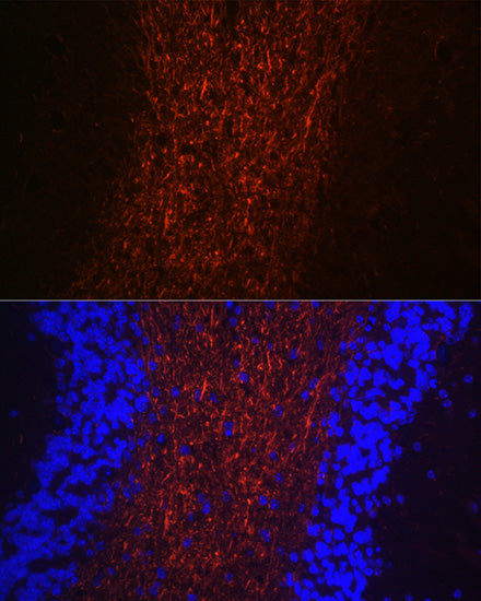 Neurofilament H Rabbit pAb