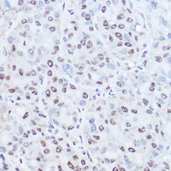 TAF15 Rabbit pAb