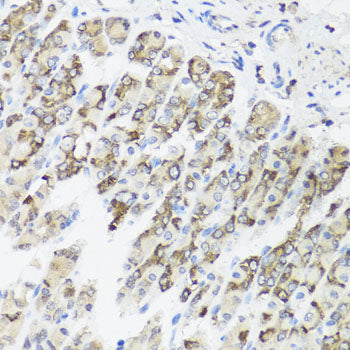 TIMM10B Rabbit pAb