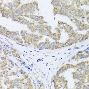 TIMM10B Rabbit pAb