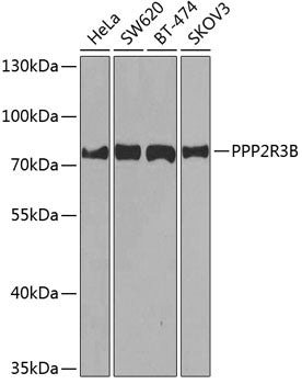 PPP2R3B Rabbit pAb