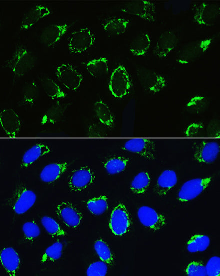 PTCD3 Rabbit pAb