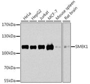 SMEK1 Rabbit pAb