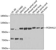PCDHA12 Rabbit pAb