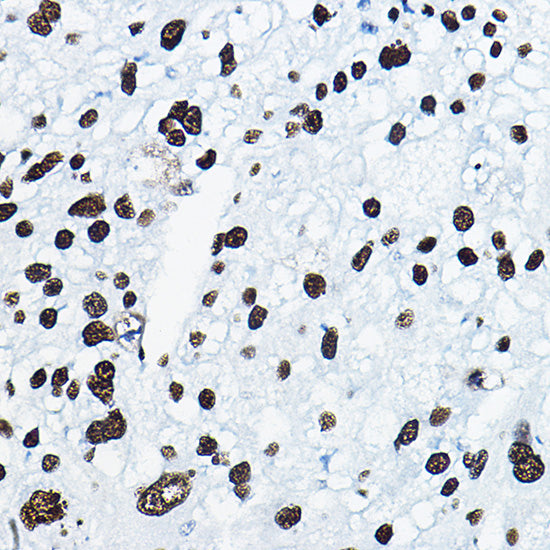 MKL1 Rabbit pAb