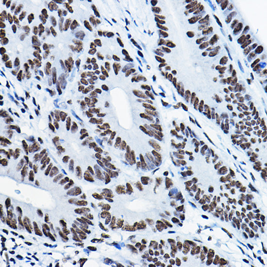 MKL1 Rabbit pAb