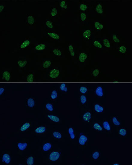 MKL1 Rabbit pAb
