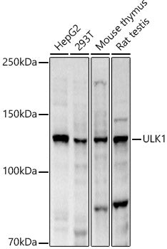 ULK1 Rabbit pAb