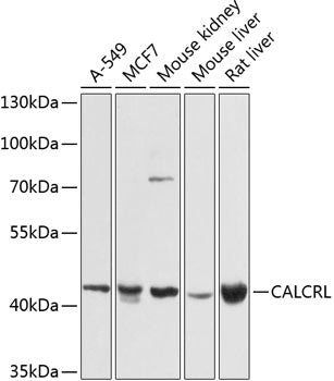 CALCRL Rabbit pAb
