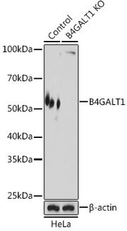 [KO Validated] B4GALT1 Rabbit pAb