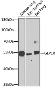 GLP1R Rabbit pAb