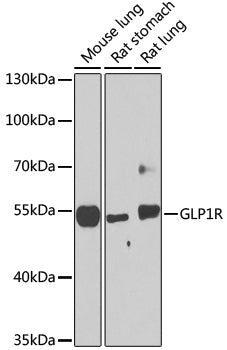 GLP1R Rabbit pAb