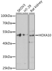HOXA10 Rabbit pAb
