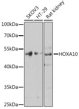 HOXA10 Rabbit pAb