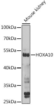 HOXA10 Rabbit pAb