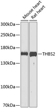 THBS2 Rabbit pAb