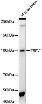 TRPV1 Rabbit pAb