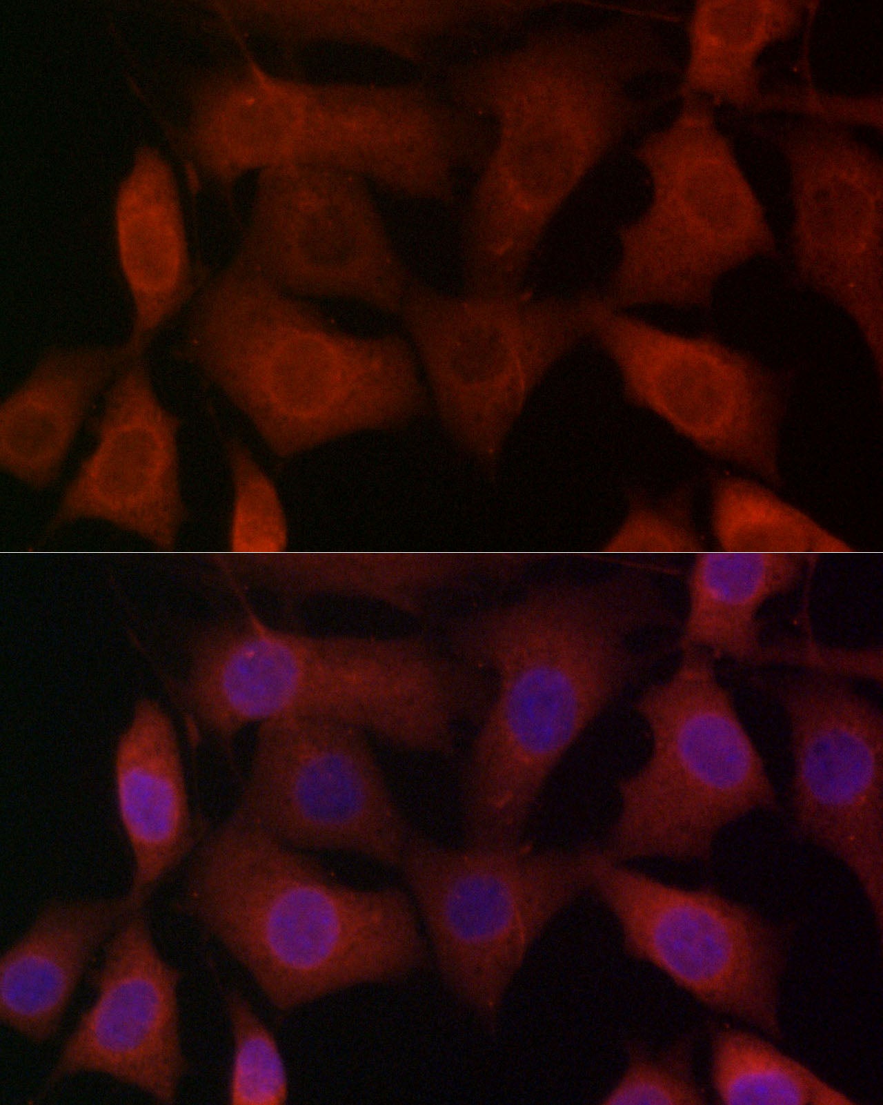 TRPV1 Rabbit pAb
