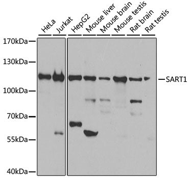 SART1 Rabbit pAb