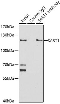 SART1 Rabbit pAb
