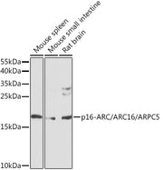 p16-ARC/ARC16/ARPC5 Rabbit pAb
