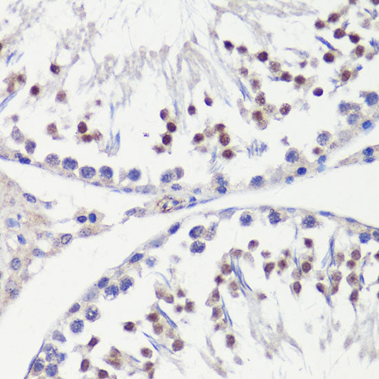 HFM1 Rabbit pAb