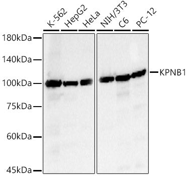 KPNB1 Rabbit pAb