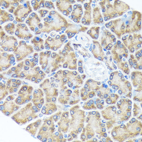 Sprouty 2 Rabbit mAb