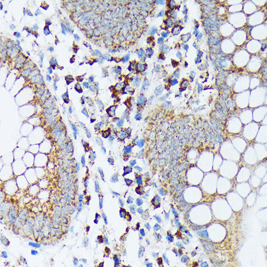 Sprouty 2 Rabbit mAb