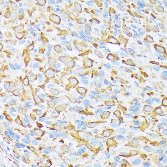 Sec23A Rabbit mAb