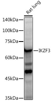 IKZF3 Rabbit mAb