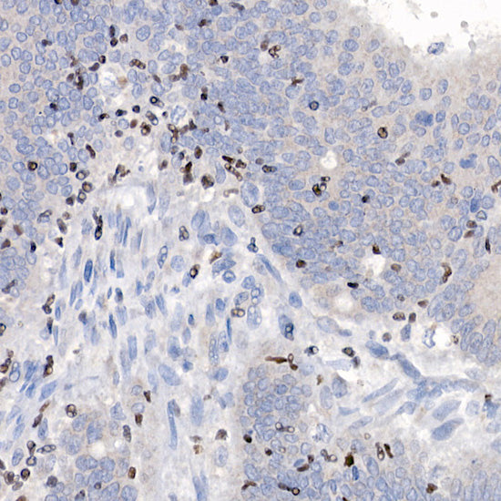 IKZF3 Rabbit mAb