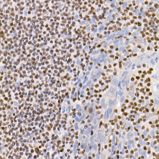IKZF3 Rabbit mAb