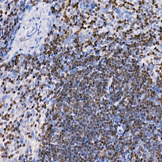 IKZF3 Rabbit mAb