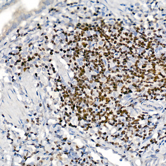 IKZF3 Rabbit mAb