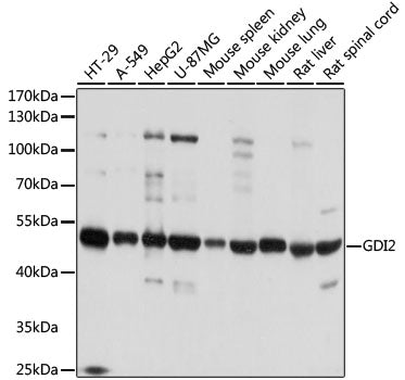 [KO Validated] GDI2 Rabbit pAb