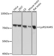 LysRS/KARS Rabbit mAb