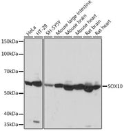 SOX10 Rabbit mAb