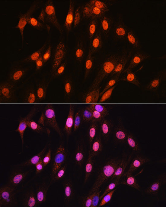 SOX10 Rabbit mAb