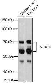 SOX10 Rabbit mAb