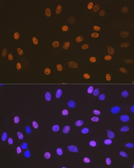 SOX10 Rabbit mAb