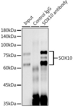 SOX10 Rabbit mAb