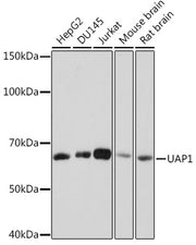 UAP1 Rabbit mAb