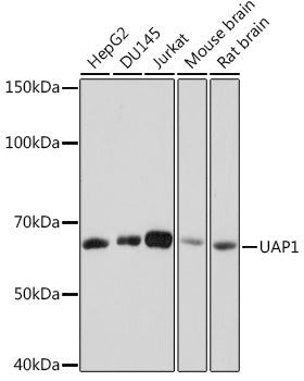 UAP1 Rabbit mAb