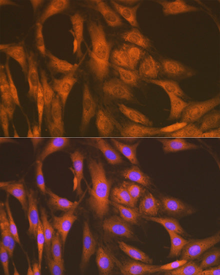 UAP1 Rabbit mAb