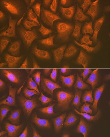UAP1 Rabbit mAb